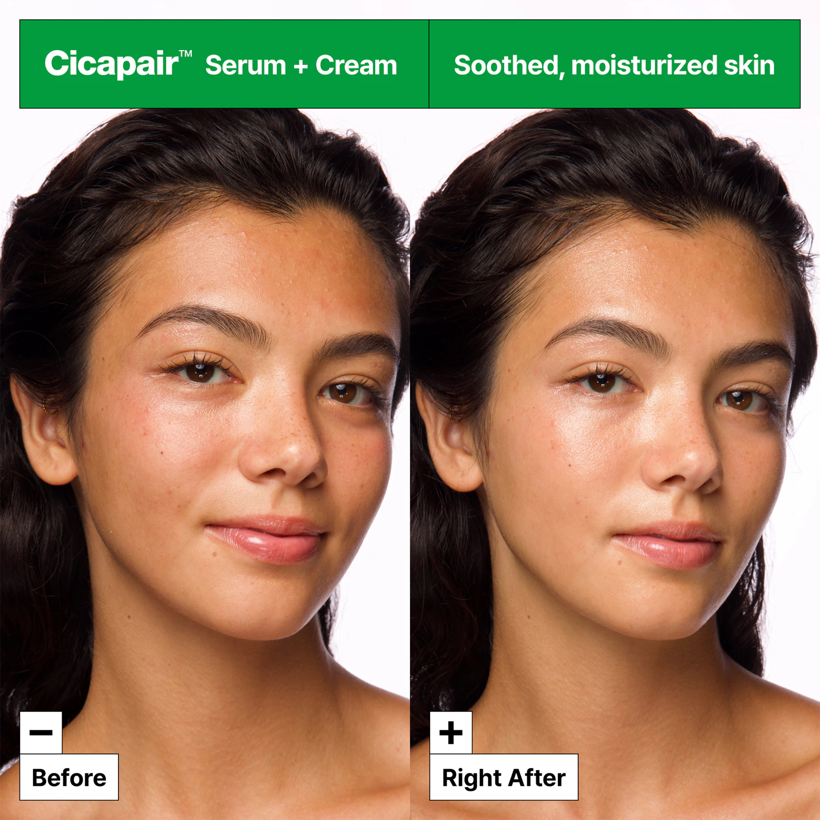 cicapair-intensive-soothing-repair-serum___250602 (2)